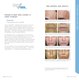 2600-029-03 Rev J BBL Photofacial before and after 2 .jpg