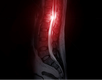 AcellOrtho_Spine 4.png